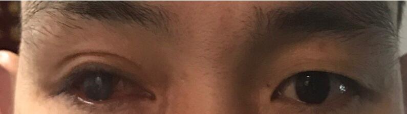 安装案例 安装案例