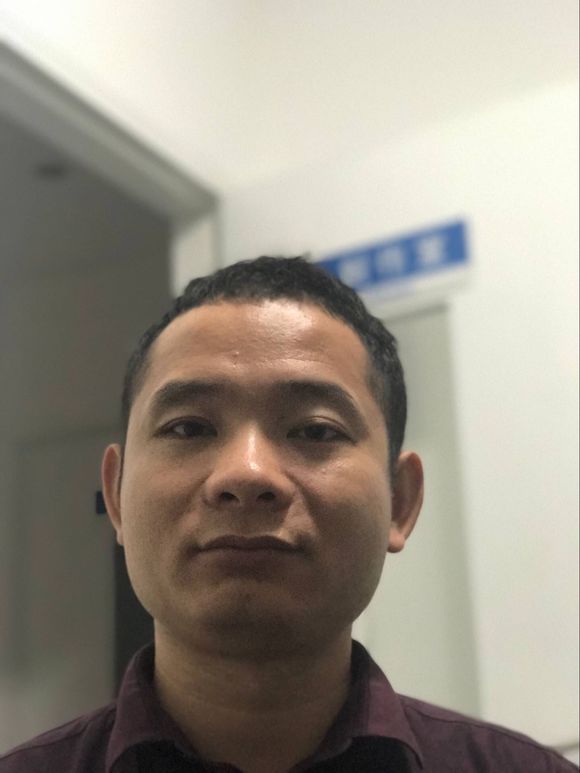 义眼安装效果图