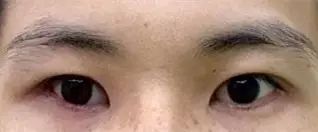 义眼的含义 义眼的含义