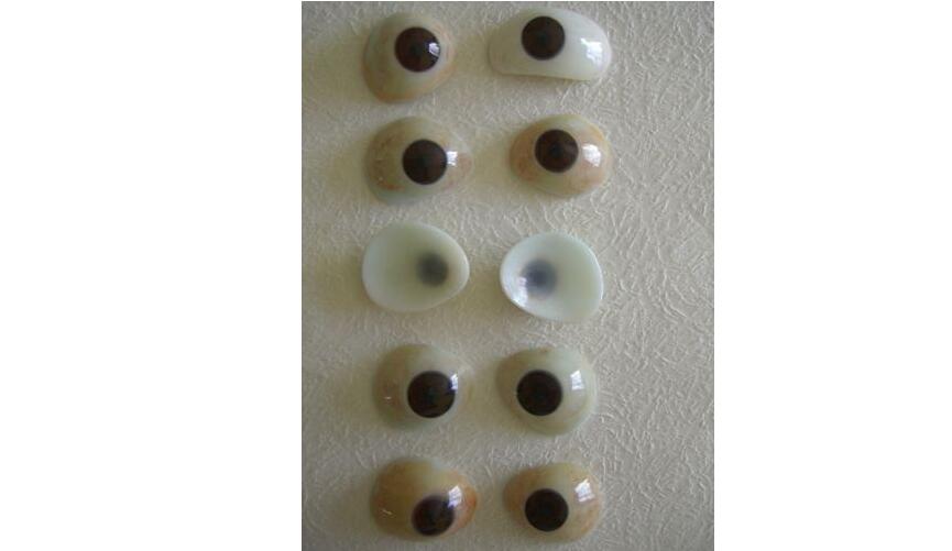 义眼片和义眼台的区别之分 义眼片和义眼台的区别之分