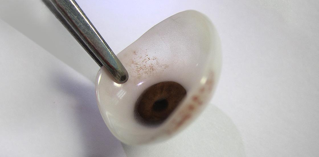 义眼薄度在0.4毫米左右