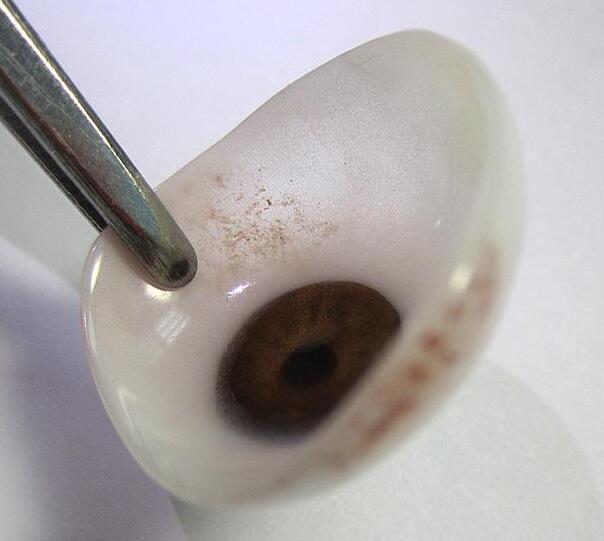 义眼具有壳薄、质轻、逼真的效果 义眼具有壳薄、质轻、逼真的效果