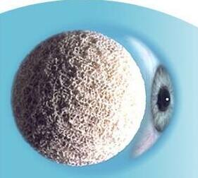 义眼台和义眼片 义眼台和义眼片